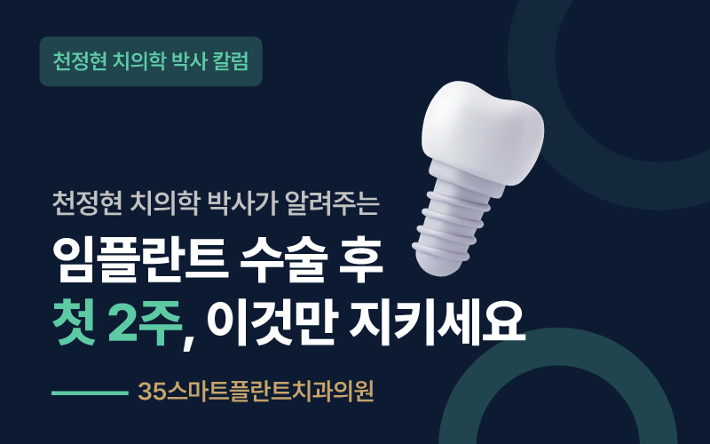 임플란트 수술 후 첫 2주, 이것만 지키세요 - 천안치과 원장 칼럼