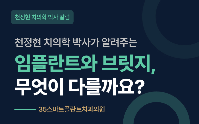 임플란트와 브릿지, 무엇이 다를까요? ? 천안치과 원장 칼럼