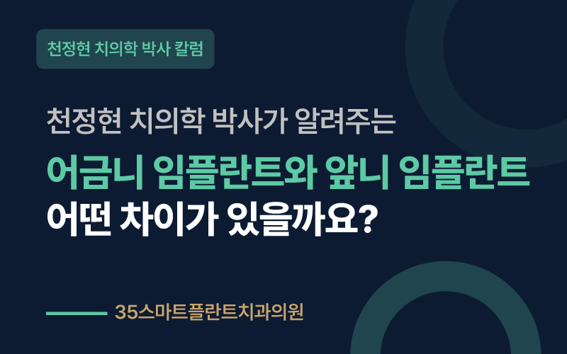 어금니 임플란트 vs 앞니 임플란트, 차이점은? - 천안치과 원장 칼럼