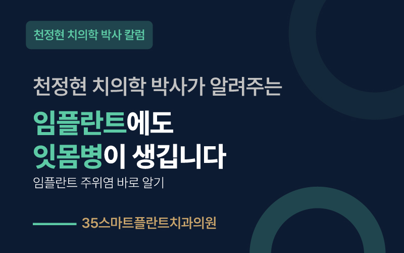 임플란트에도 잇몸병이 생깁니다 - 임플란트 주위염 바로 알기, 천안치과 원장 칼럼